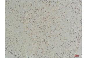 Immunohistochemistry (IHC) analysis of paraffin-embedded Mouse Brain Tissue using Connexin-26Rabbit Polyclonal Antibody diluted at 1:200. (GJB2 Antikörper)