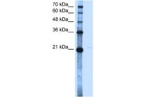 OLR1 antibody used at 2. (OLR1 Antikörper)