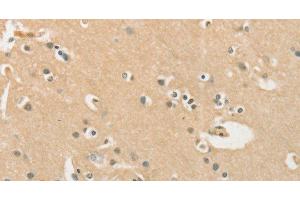 Immunohistochemistry of paraffin-embedded Human brain using CHRNA2 Polyclonal Antibody at dilution of 1:40 (CHRNA2 Antikörper)