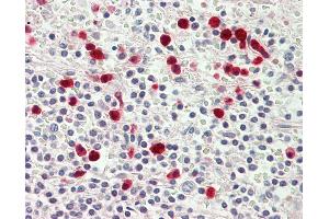 Anti-MYO1E / Myosin IE antibody IHC staining of human spleen. (MYO1E Antikörper  (AA 228-257))