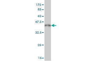 Western Blot detection against Immunogen (37. (PDE5A Antikörper  (AA 29-138))