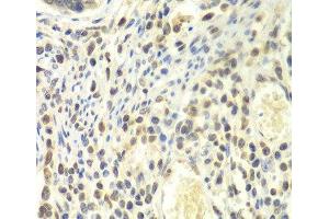 Immunohistochemistry of paraffin-embedded Human colon using PSMA4 Polyclonal Antibody at dilution of 1:100 (40x lens). (PSMA4 Antikörper)