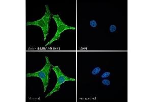ABIN185280 Immunofluorescence analysis of paraformaldehyde fixed HeLa cells, permeabilized with 0. (ANTXR1 Antikörper  (C-Term))