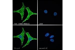 ABIN185280 Immunofluorescence analysis of paraformaldehyde fixed HeLa cells, permeabilized with 0.
