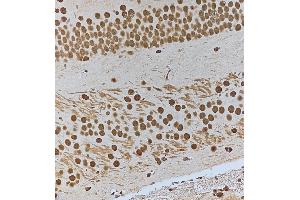 ABIN6256259 and ABIN6267581 at 1/100 staining Mouse brain tissue by IHC-P.