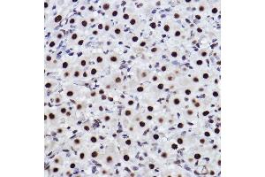 Immunohistochemistry (IHC) image for anti-C-terminal Binding Protein 2 (CTBP2) antibody (ABIN7265979)