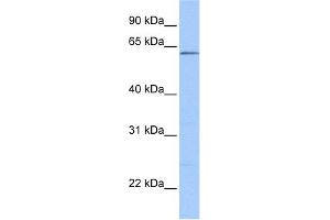 WB Suggested Anti-ZKSCAN4 Antibody Titration:  0. (ZKSCAN4 Antikörper  (N-Term))