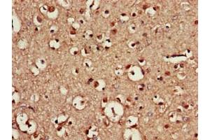 anti-Caudal Type Homeobox 4 (CDX4) (AA 16-174) antibody