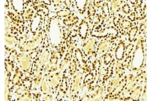 ABIN6275007 at 1/100 staining Mouse kidney tissue by IHC-P. (CLIC4 Antikörper  (N-Term))