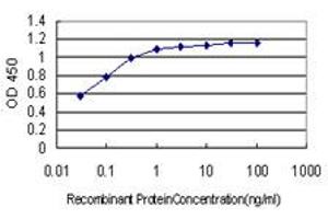 Detection limit for recombinant GST tagged BCL9 is approximately 0. (BCL9 Antikörper  (AA 1036-1135))