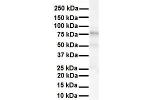 WB Suggested Anti-KCNC3 antibody Titration: 1 ug/mL Sample Type: Human liver (KCNC3 Antikörper  (Middle Region))