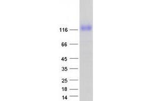 Western Blotting (WB) image for Seizure Related 6 Homolog Like 2 (SEZ6L2) (Transcript Variant 3) protein (Myc-DYKDDDDK Tag) (ABIN2731887)