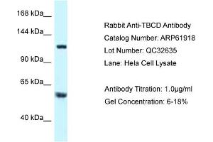 Western Blotting (WB) image for anti-Tubulin Folding Cofactor D (TBCD) (N-Term) antibody (ABIN2788948) (TBCD Antikörper  (N-Term))