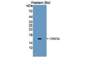 Western Blotting (WB) image for anti-Carcinoembryonic Antigen-Related Cell Adhesion Molecule 6 (CEACAM6) (AA 35-142) antibody (ABIN1867173) (CEACAM6 Antikörper  (AA 35-142))