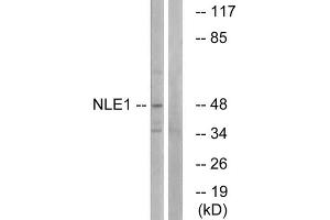 Western blot analysis of extracts from COS cells, using NLE1 antibody. (NLE1 Antikörper  (Internal Region))