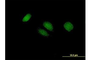 Immunofluorescence of purified MaxPab antibody to BTG4 on HeLa cell.