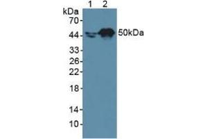 Western blot analysis of (1) Human A431 Cells and (2) Human HepG2 Cells. (Retinoic Acid Receptor alpha Antikörper  (AA 237-459))