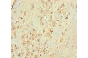 Immunohistochemistry of paraffin-embedded human placenta tissue using ABIN7171488 at dilution of 1:100 (TLN2 Antikörper  (AA 88-406))