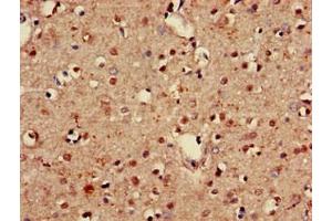 Immunohistochemistry of paraffin-embedded human brain tissue using ABIN7153517 at dilution of 1:100 (GABARAPL1 Antikörper  (AA 1-117))