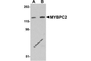 Western Blotting (WB) image for anti-Myosin Binding Protein C, Fast Type (MYBPC2) (C-Term) antibody (ABIN1030525) (MYBPC2 Antikörper  (C-Term))