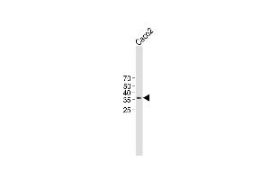 All lanes : Anti-TMEM150B Antibody (N-term) at 1:1000 dilution Lane 1 : Caco2 whole cell lysate Lysates/proteins at 20 μg per lane. (TMEM150B Antikörper  (N-Term))