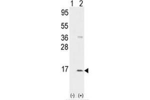 Western blot analysis of PPBP (arrow) using rabbit polyclonal PPBP Antibody (CXCL7 Antikörper  (N-Term))