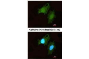 ICC/IF Image Immunofluorescence analysis of methanol-fixed HeLa, using DIP2B, antibody at 1:200 dilution. (DIP2B Antikörper  (C-Term))