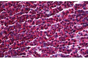 Immunohistochemistry (Formalin-fixed Paraffin-embedded Sections) (IHC (fp)) image for anti-Protein Kinase, Interferon-Inducible Double Stranded RNA Dependent Activator (PRKRA) (AA 1-314) antibody (ABIN626078)