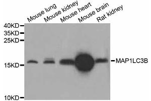 Western blot analysis of extracts of various cell lines, using MAP1LC3B antibody (ABIN4904290) at 1:1000 dilution. (LC3B Antikörper)