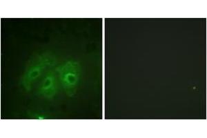 Immunofluorescence analysis of HeLa cells, using p47 phox (Phospho-Ser359) Antibody. (NCF1 Antikörper  (pSer359))