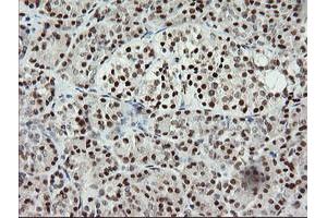 Image no. 2 for anti-Malignant T Cell Amplified Sequence 1 (MCTS1) (AA 1-181) antibody (ABIN1490599)