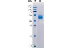 Human MICB Protein, His Tag on SDS-PAGE under reducing condition.