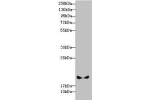 Western blot All lanes: BLOC1S6 antibody at 3. (Pallidin Antikörper  (AA 1-170))