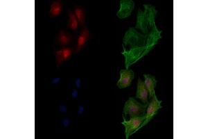 ABIN6265199 and ABIN6273321 staining  cells by IF/ICC. (SMYD3 Antikörper  (N-Term))