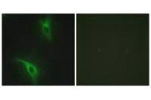 Immunofluorescence analysis of HeLa cells, using CKS1 antibody. (CKS1 Antikörper  (N-Term))