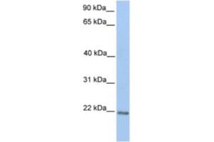 Western Blotting (WB) image for anti-Zinc Finger Protein 548 (ZNF548) antibody (ABIN2461998) (ZNF548 Antikörper)