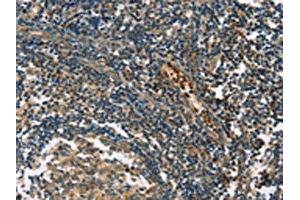 The image on the left is immunohistochemistry of paraffin-embedded Human tonsil tissue using ABIN7190849(GPR182 Antibody) at dilution 1/30, on the right is treated with synthetic peptide. (G Protein-Coupled Receptor 182 Antikörper)