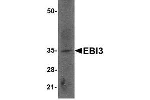Western blot analysis of EBI3 in rat spleen tissue lysate with AP30307PU-N EBI3 antibody at 2 μg/ml. (EBI3 Antikörper  (Center))