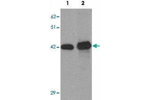 Western blot analysis of SLC39A12 in HepG2 cell lysate with SLC39A12 polyclonal antibody  at (1) 0. (SLC39A12 Antikörper  (N-Term))