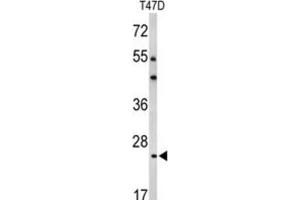 Western Blotting (WB) image for anti-BCL2-Related Protein A1 (BCL2A1) antibody (ABIN2997079) (BCL2A1 Antikörper)
