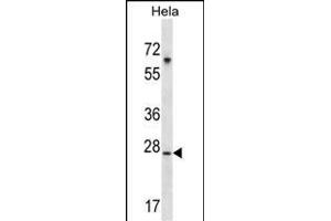 SRPK1 Antibody (M1) (ABIN391794 and ABIN2841649) western blot analysis in Hela cell line lysates (35 μg/lane). (SRPK1 Antikörper  (N-Term))