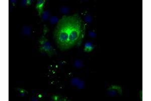 Image no. 3 for anti-Nucleotide Exchange Factor SIL1 (SIL1) antibody (ABIN1496809) (SIL1 Antikörper)