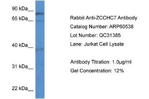 WB Suggested Anti-ZCCHC7  Antibody Titration: 0. (ZCCHC7 Antikörper  (C-Term))