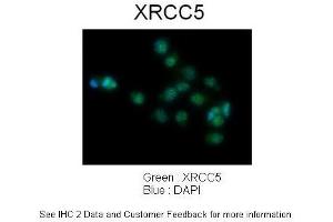 Immunohistochemistry (IHC) image for anti-X-Ray Repair Complementing Defective Repair in Chinese Hamster Cells 5 (Double-Strand-Break Rejoining) (XRCC5) (C-Term) antibody (ABIN2778271)