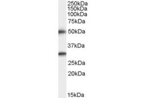 Western Blotting (WB) image for anti-Transmembrane Protease, serine 5 (TMPRSS5) (C-Term) antibody (ABIN2466316) (TMPRSS5 Antikörper  (C-Term))