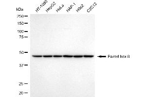 Western blotting analysis using paired box 8 antibody (ABIN7799726).