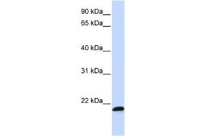 WB Suggested Anti-C21orf56 Antibody Titration:  0. (C21ORF56 Antikörper  (Middle Region))