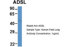 Host: Rabbit  Target Name: ADSL  Sample Tissue: Human Fetal Lung  Antibody Dilution: 1. (Adenylosuccinate Lyase Antikörper  (Middle Region))