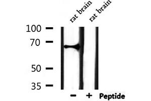 Western blot analysis of extracts from rat brain, using ATG16L2 Antibody. (ATG16L2 Antikörper  (Internal Region))