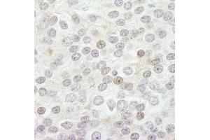 Immunohistochemistry (IHC) image for anti-Lysine (K)-Specific Demethylase 5B (KDM5B) (AA 1494-1544) antibody (ABIN7448613) (KDM5B Antikörper  (AA 1494-1544))